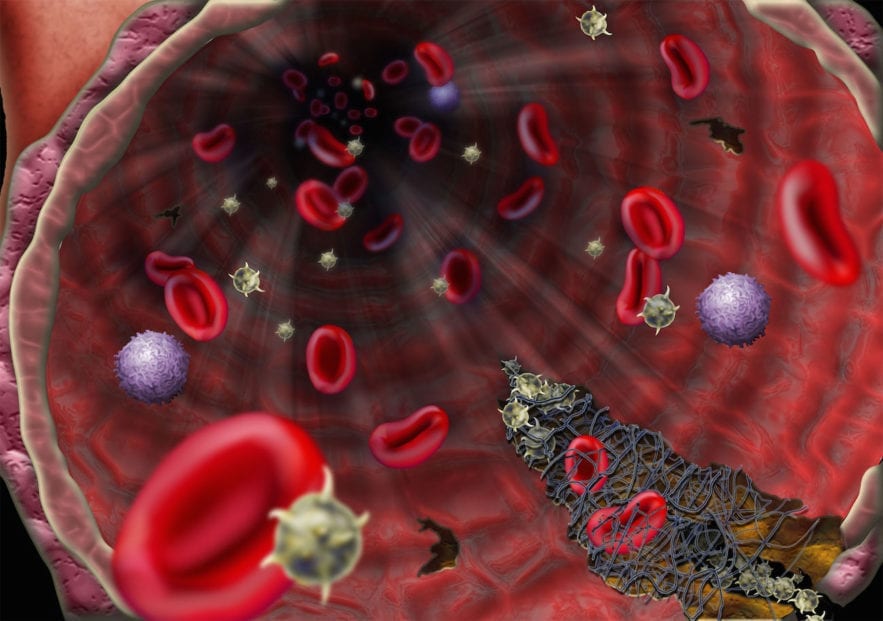 ebola virus traitement plasma convalescent