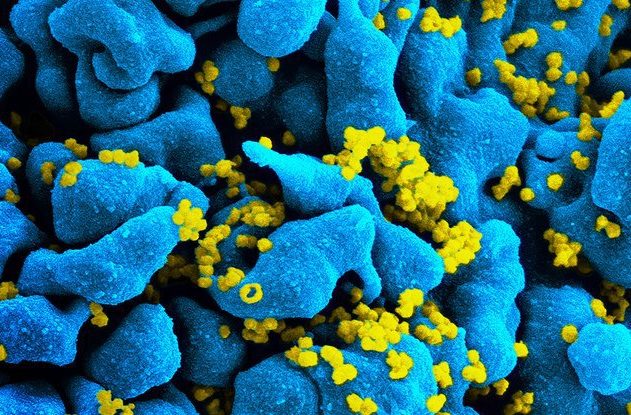 virus du sida, vih, nouveau remède, médicament