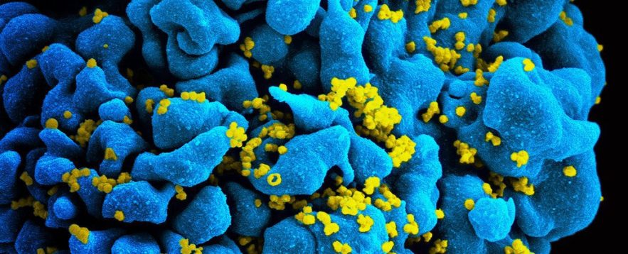 virus du sida, vih, nouveau remède, médicament