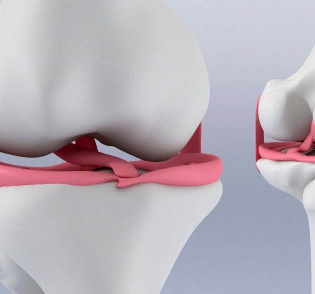 genou menisque cartilage hydrogel