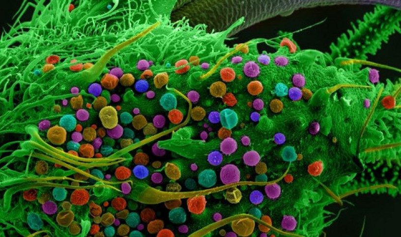marijuana THC microscope