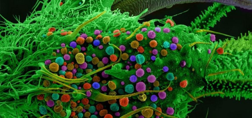 marijuana THC microscope
