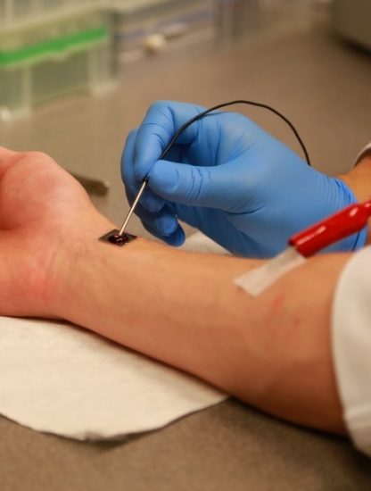 nanopuce cellule réparation organes bras technologie