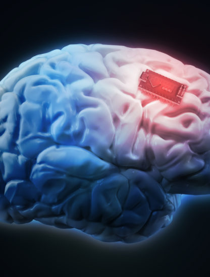 cerveau augmentation boost mémoire implant