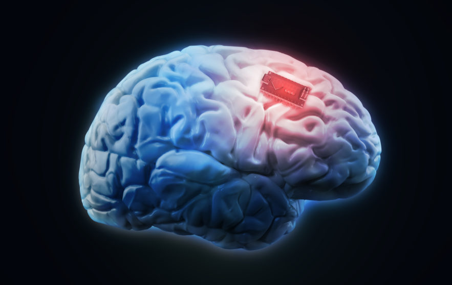 cerveau augmentation boost mémoire implant