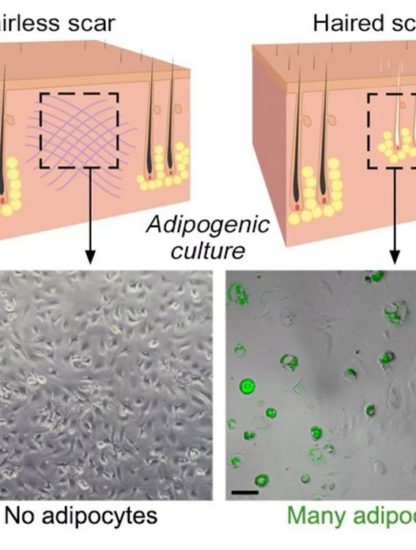 peau cellule peau régénération blessure plaie cicatrice