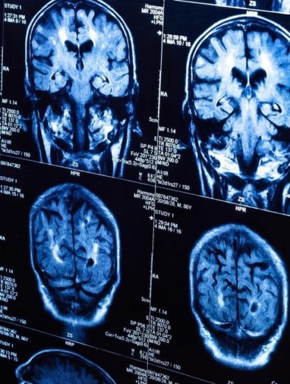 cerveau irm irmf imagerie résonnance réponse suivi tracking pensée timing