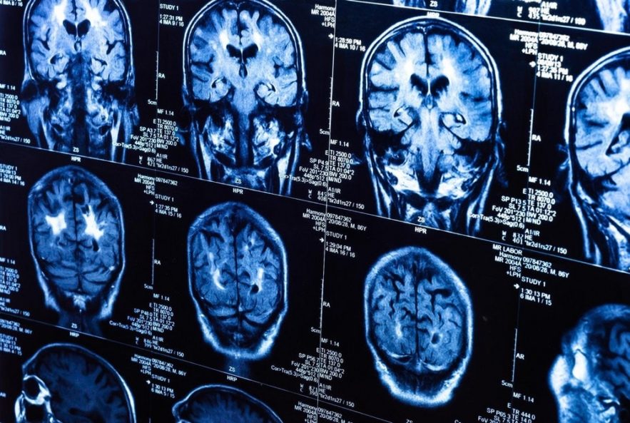 cerveau irm irmf imagerie résonnance réponse suivi tracking pensée timing