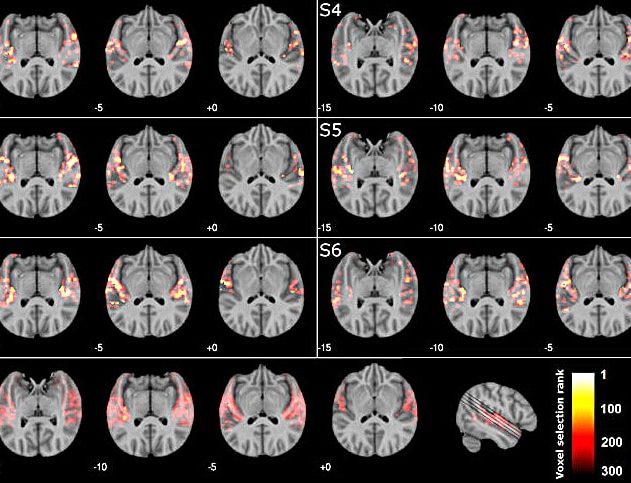cerveau reconnaitre musique irm