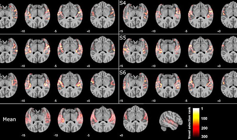 cerveau reconnaitre musique irm
