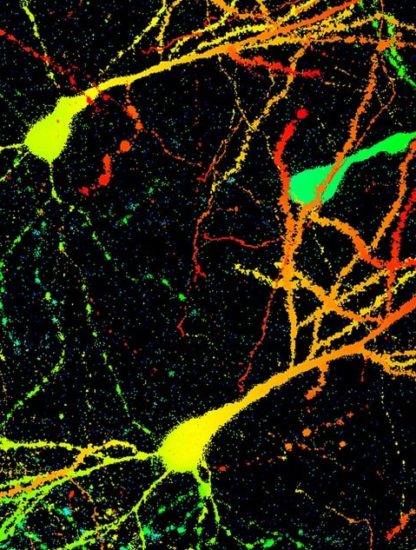 souris cerveau cellules neurones anxiete
