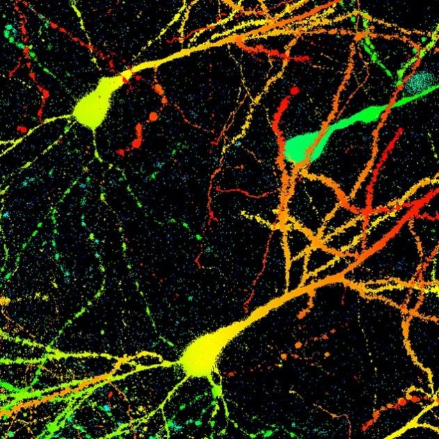 souris cerveau cellules neurones anxiete