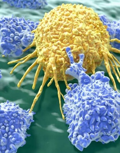 LT cancer