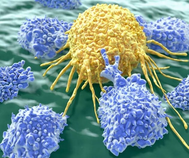 LT cancer