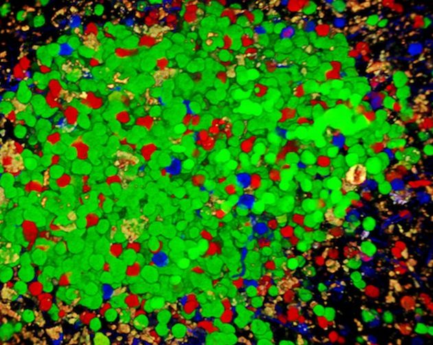 cellule b lymphocyte système immunitaire maladie auto immune