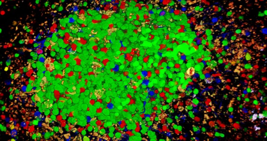 cellule b lymphocyte système immunitaire maladie auto immune