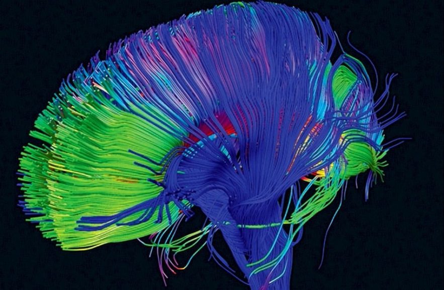 cerveau lsd psychédélique drogue harmoniser cerveau connexion neurones