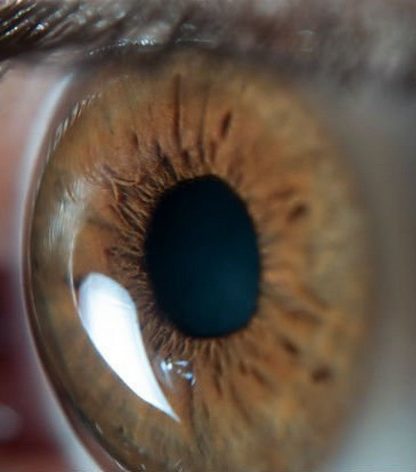 yeux oeil degenerescence maculaire traitement