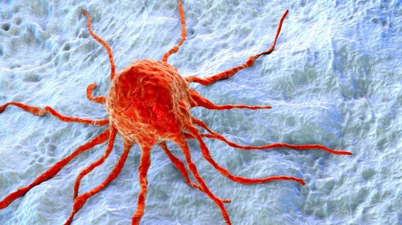 cancer sein chimiotherapie non necessaire recidive stade precoce