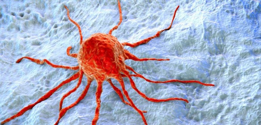 cancer sein chimiotherapie non necessaire recidive stade precoce