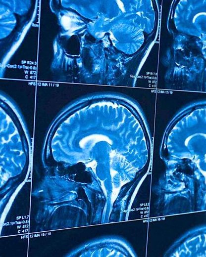 liquide sang cerveau decouverte