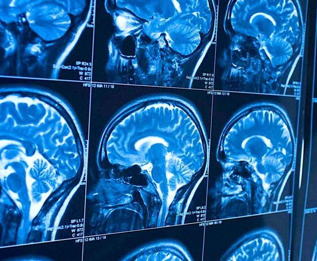 liquide sang cerveau decouverte