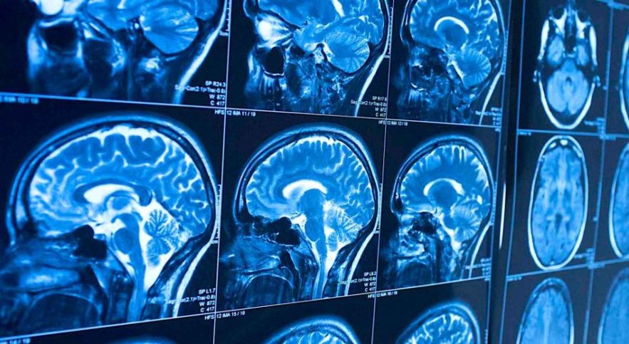 liquide sang cerveau decouverte