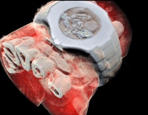 scanner mars imagerie medicale rayons X