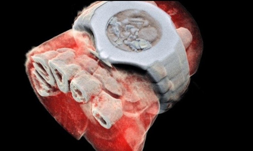 scanner mars imagerie medicale rayons X