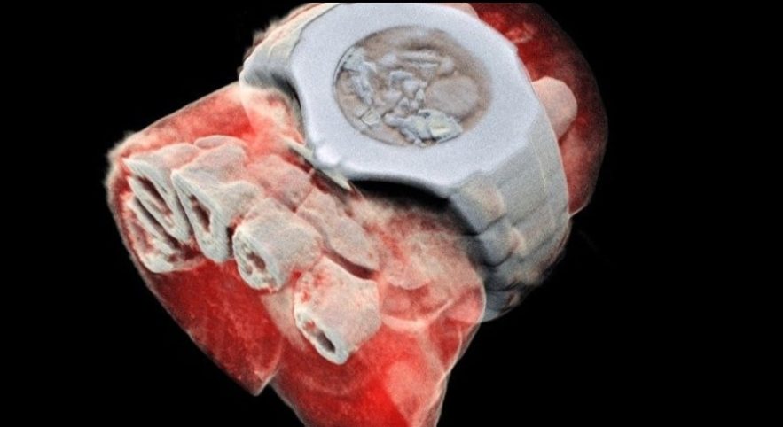 scanner mars imagerie medicale rayons X