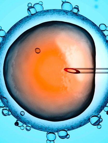 fecondation in vitro fiv
