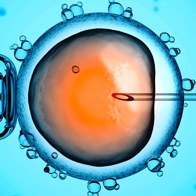 fecondation in vitro fiv