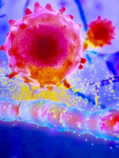 Sclerose en plaque auto antigene myeline