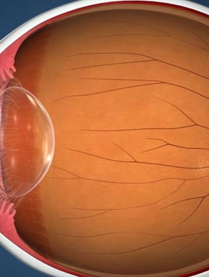 retine organoide laboratoire oeil