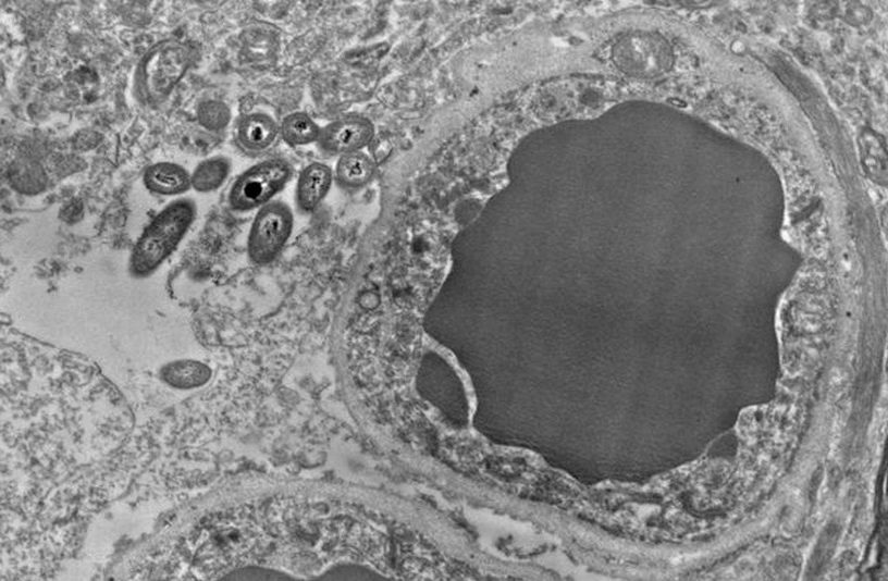 bacterie microbe cerveau intestins