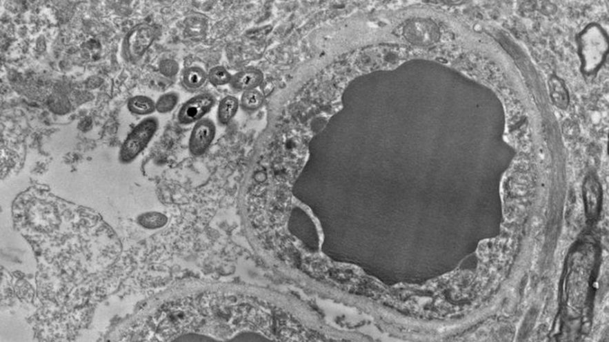 bacterie microbe cerveau intestins