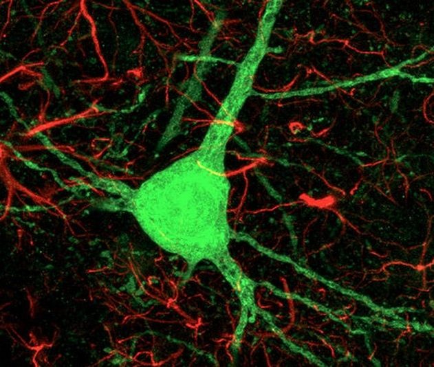 cellules astrocytes neurones reprogrammees