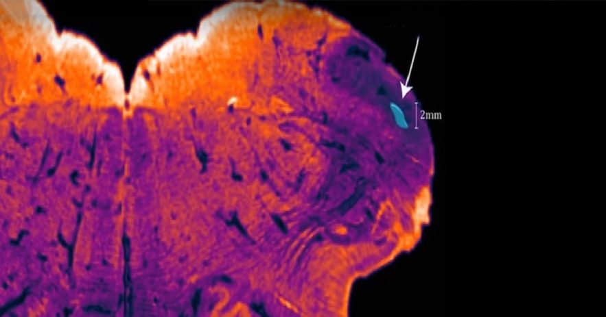 noyau endorestiforme cerveau humain