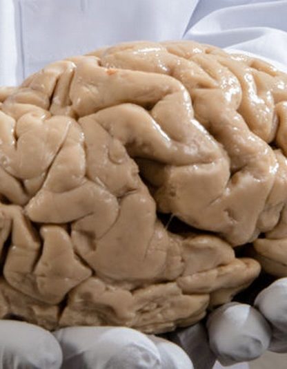 cerveau anatomie autisme trouble neurologique neurologie schizophrenie bipolaire