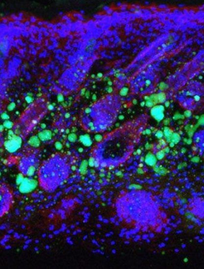 cellule cellules peau immunite perte graisse