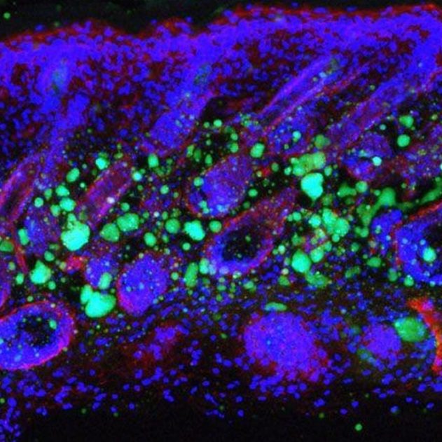 cellule cellules peau immunite perte graisse