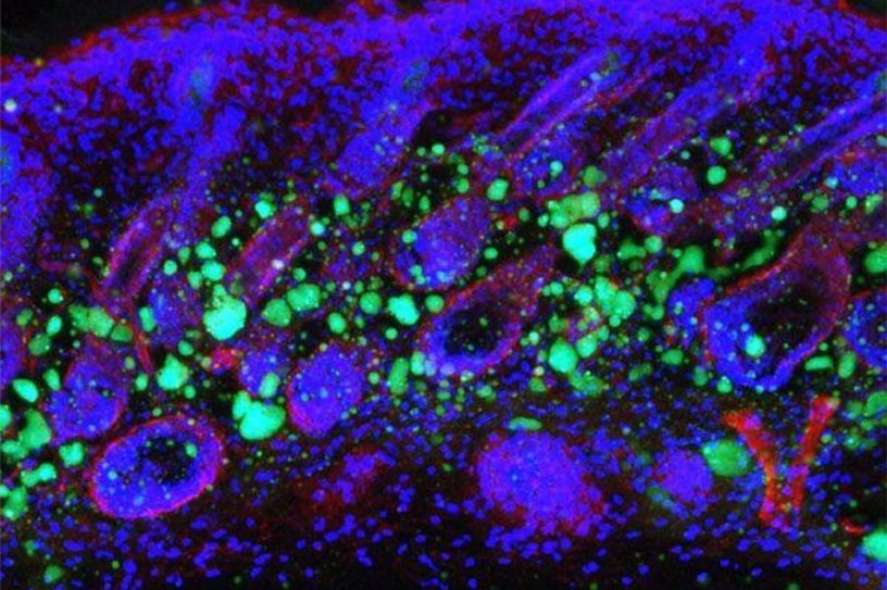 cellule cellules peau immunite perte graisse