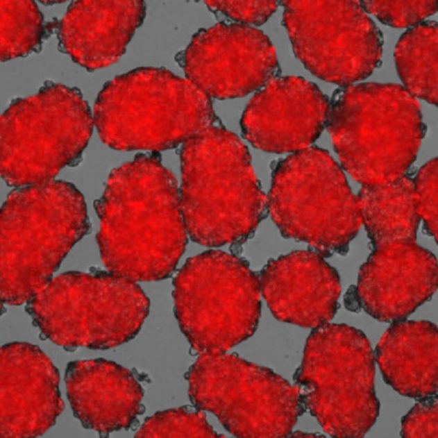 cellules souches diabete