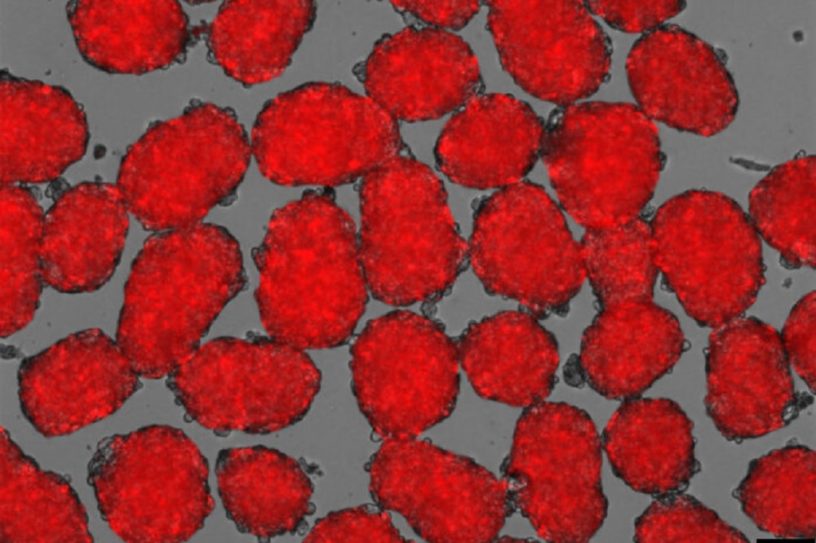 cellules souches diabete