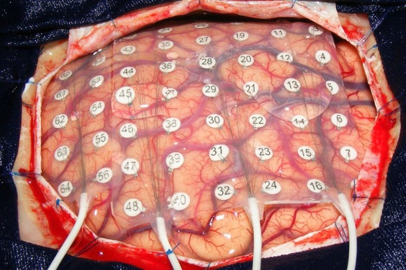 cerveau electrodes paroles