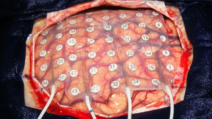 cerveau electrodes paroles
