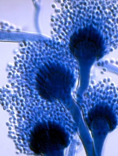 aspergillus-fumigatus-microscope