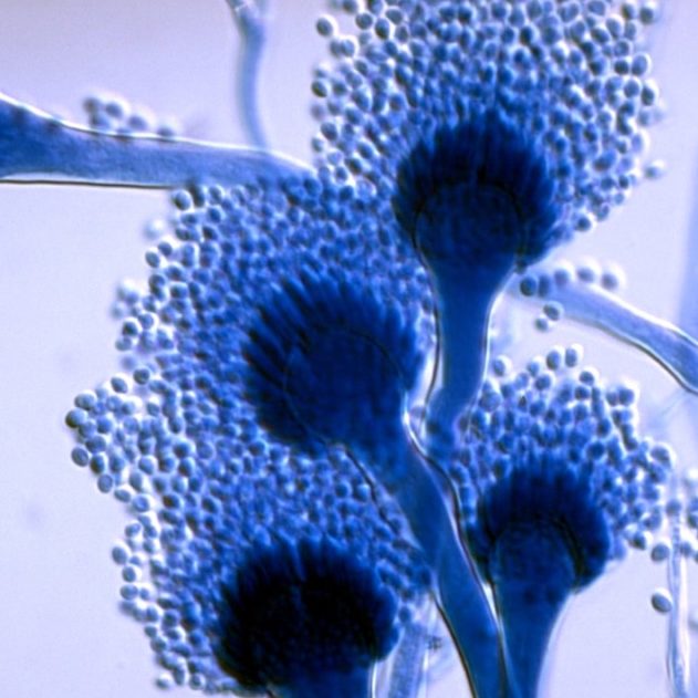 aspergillus-fumigatus-microscope