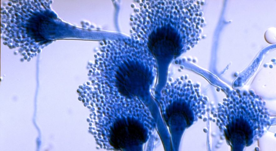 aspergillus-fumigatus-microscope