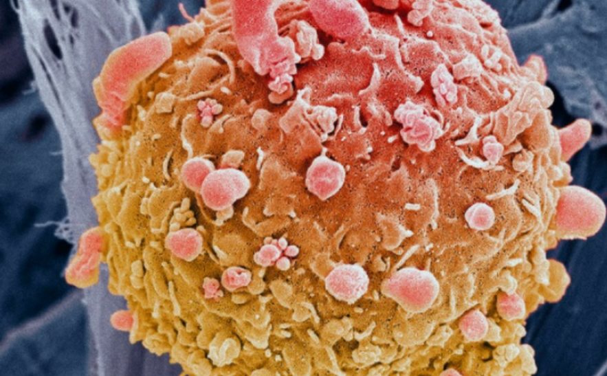 cancer genese traitement